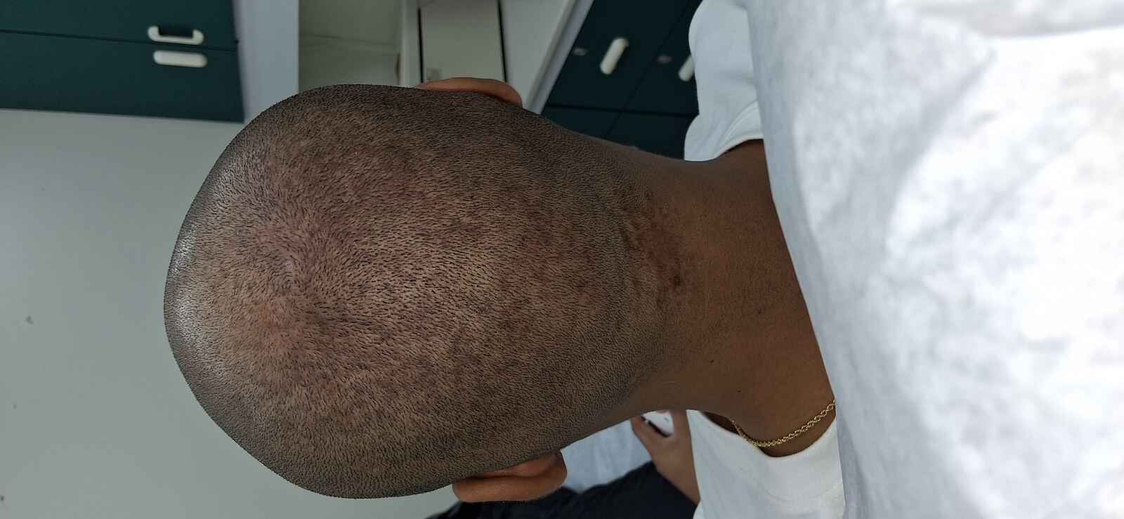 Después - Caso clínico: Dermatitis