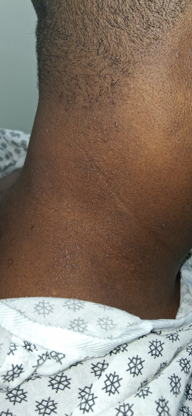 Después - Caso clínico: Dermatitis por contacto