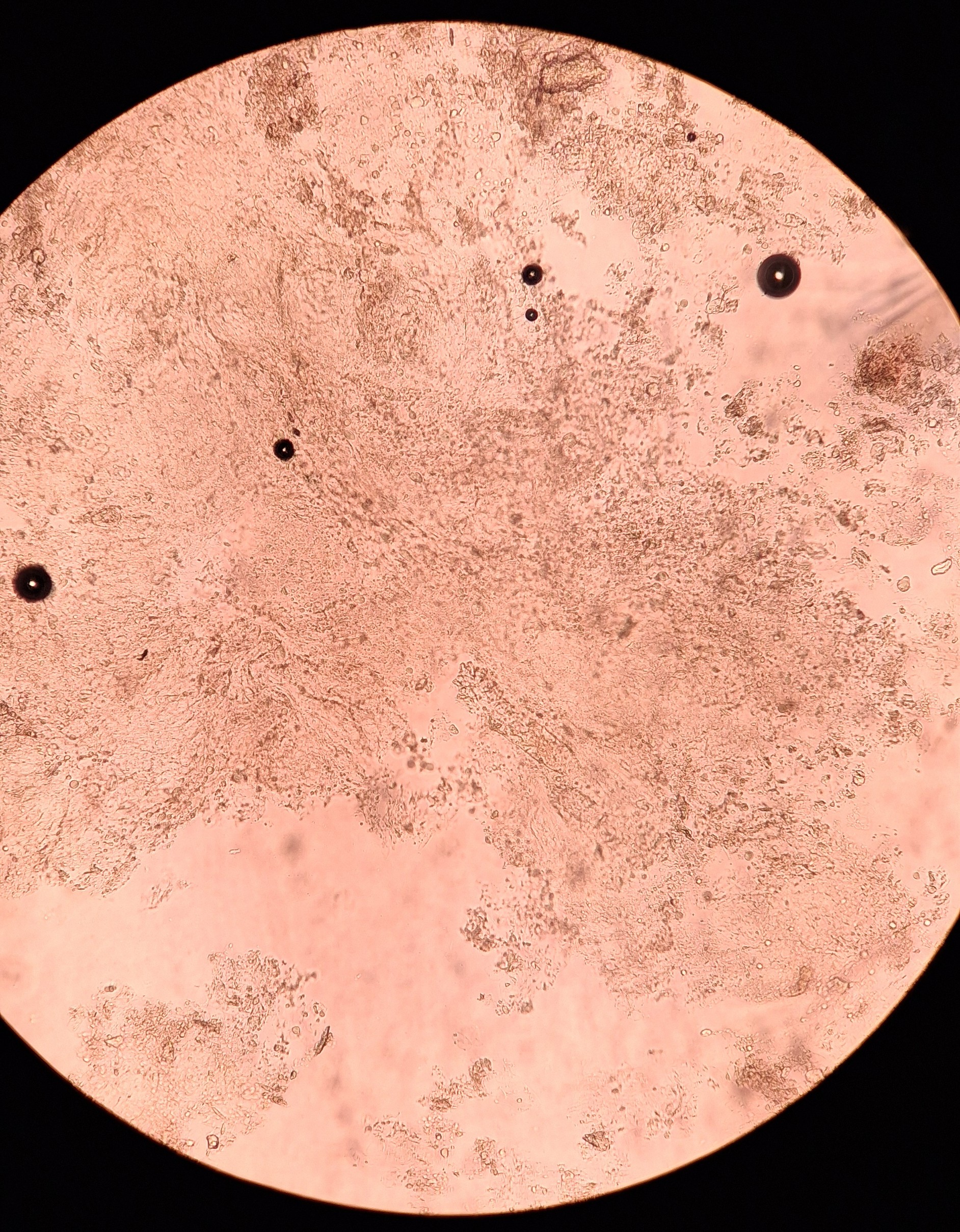 Caso clínico: Dermatitis seborreica