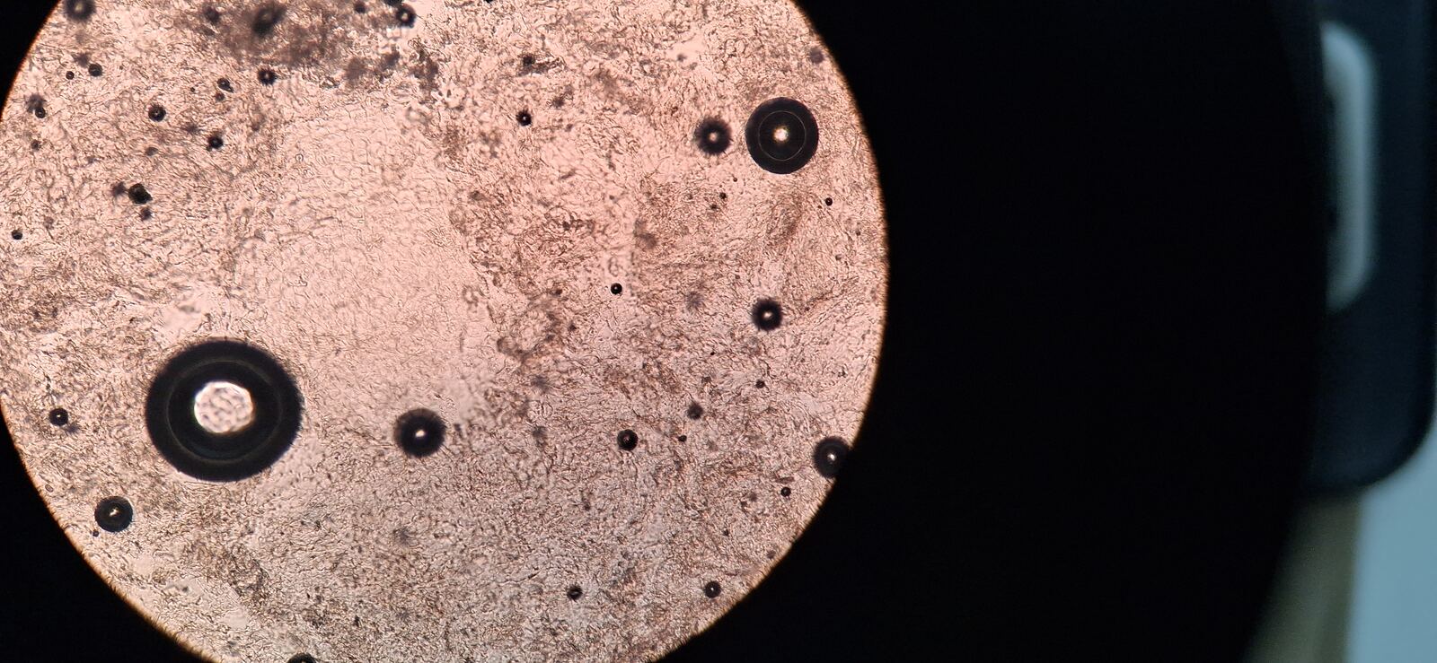 Antes - Caso clínico: Disqueratosis