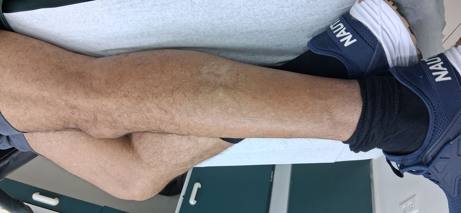 Caso clínico: Neurodermatitis